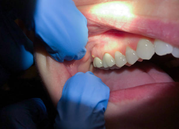 Best Orthodontic Emergency Dentist in Fort Valley, GA