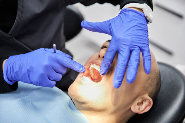Best Broken or Cracked Tooth Emergency Dentist in Fort Valley, GA